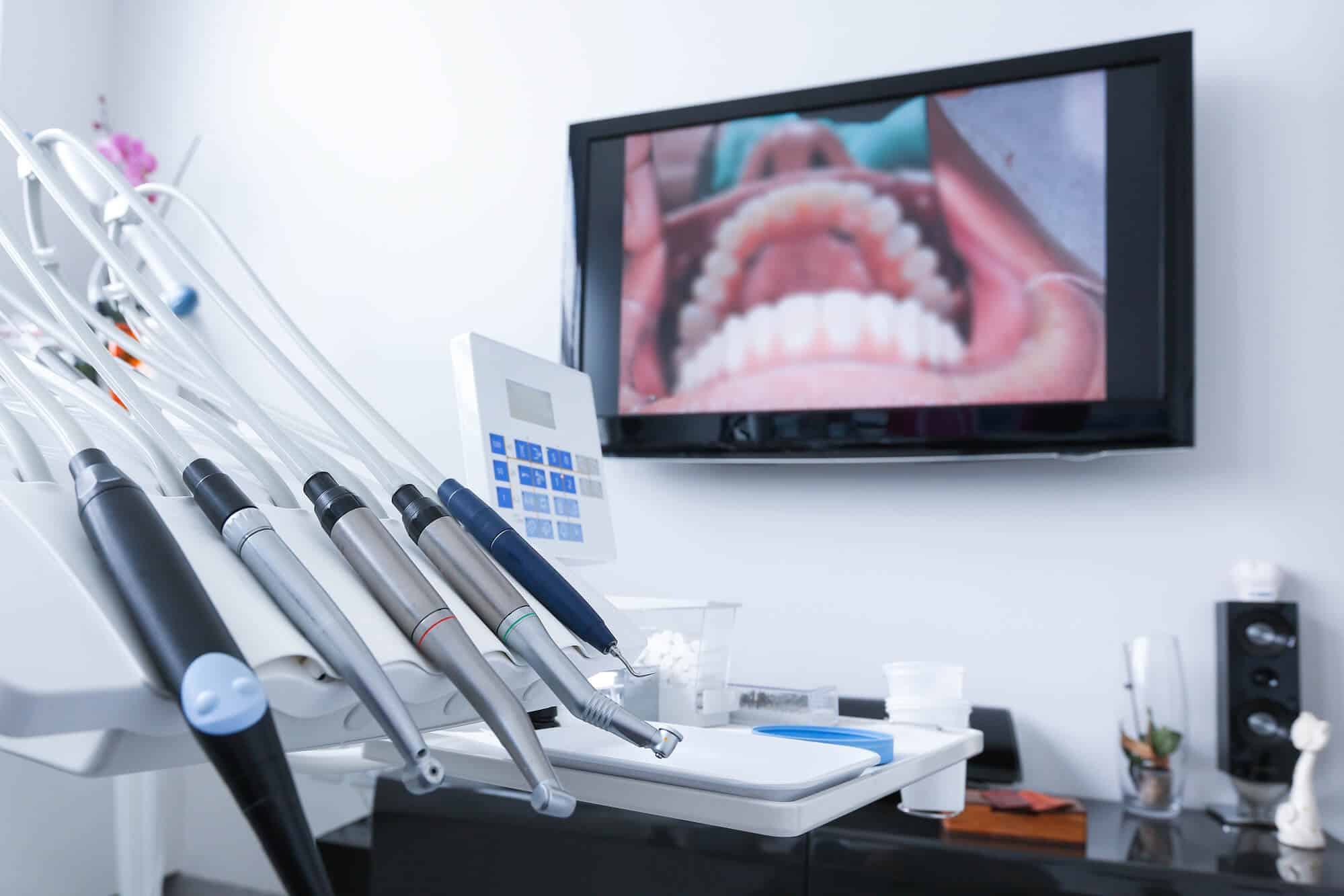 general dentistry wilmington procedure on the monitor