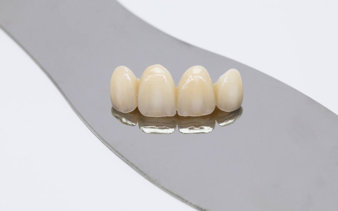 dental crowns wilmington model