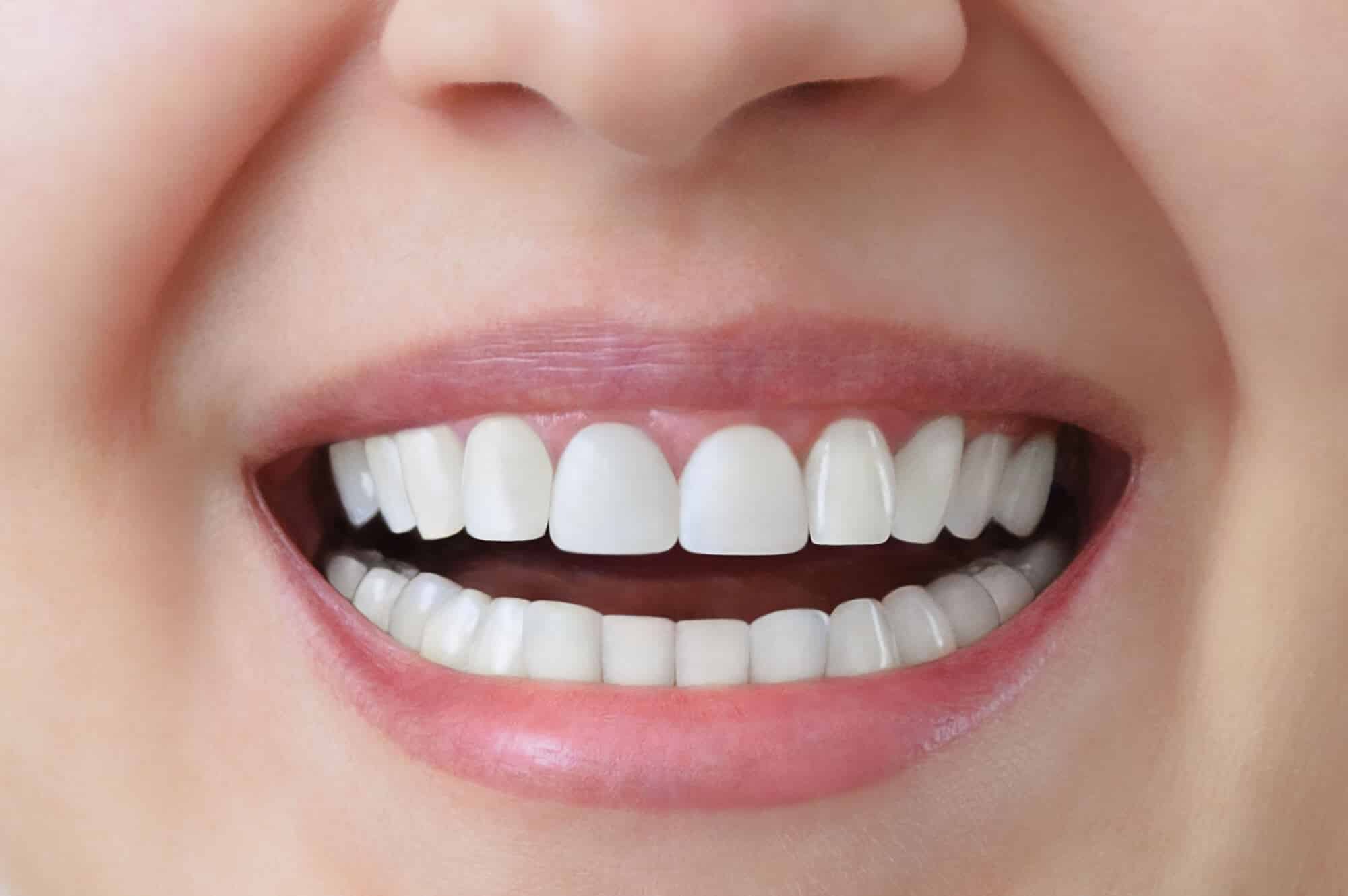 woman proudly showing her dental crowns wilmington