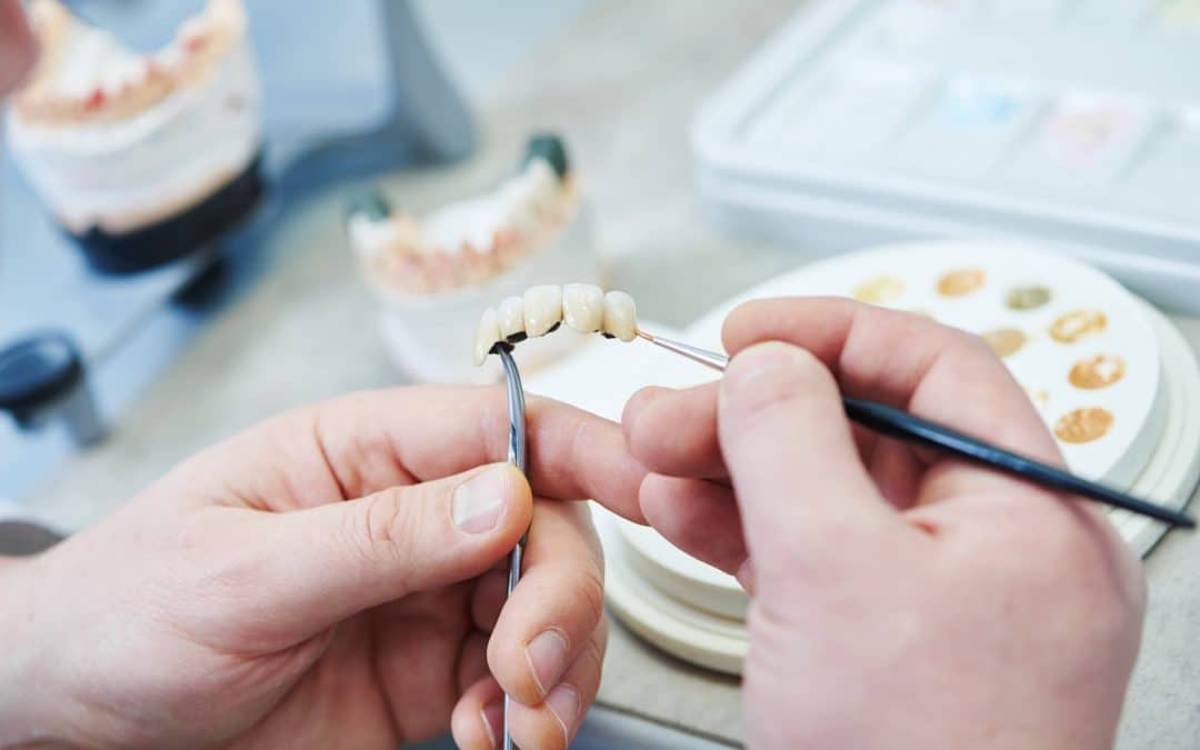 7 Compelling Reasons to Consider a Dental Bridge