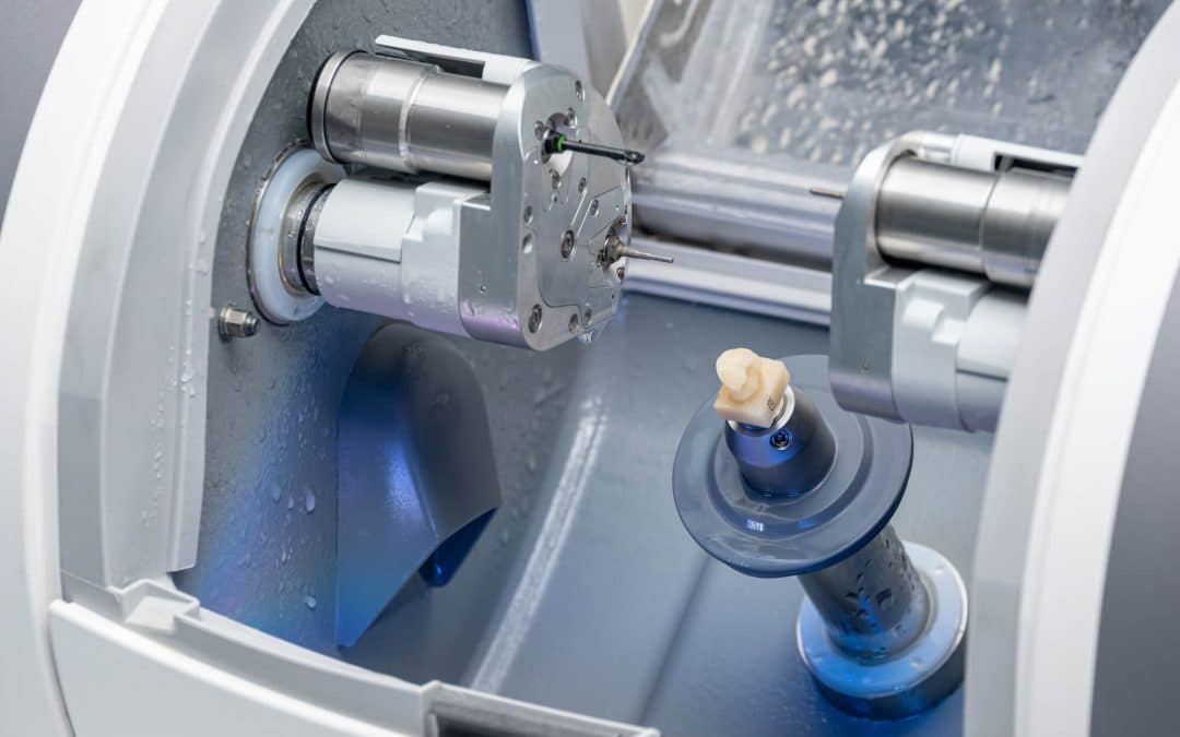 Crafting Perfection Quickly: The Technology Behind Same-Day Crowns