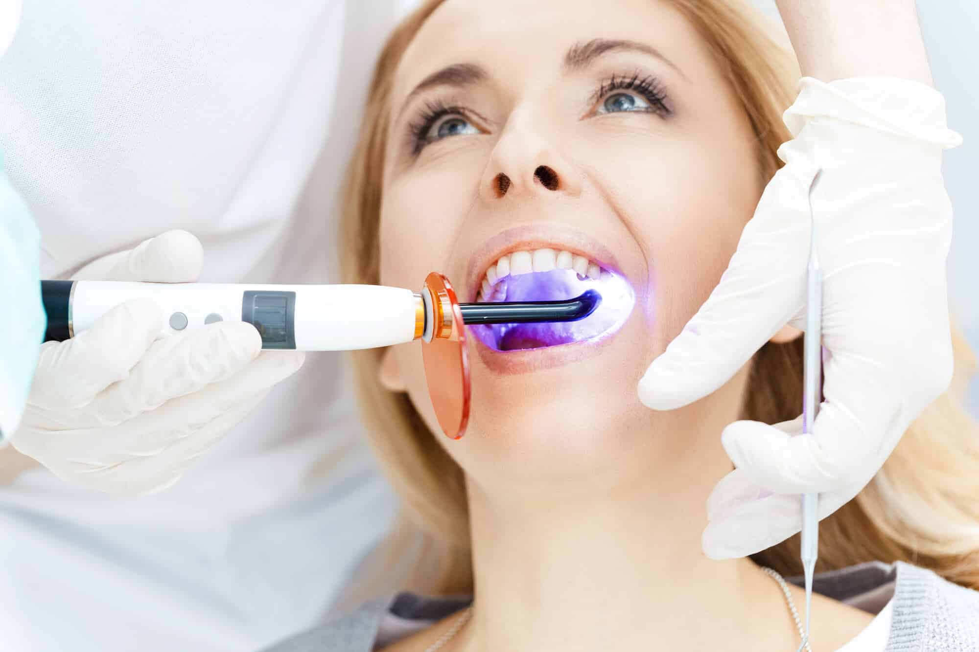 teeth whitening wilmington process